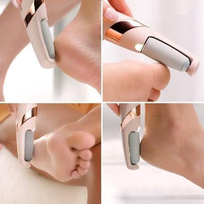 Cordless Electric Foot Callus Remover | Salon-Smooth Heels in Minutes (Rechargeable, Pain-Free)