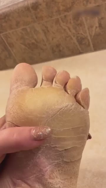 Cordless Electric Foot Callus Remover | Salon-Smooth Heels in Minutes (Rechargeable, Pain-Free)